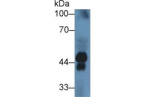Rabbit Capture antibody from the kit in WB with Positive Control: Sample Human serum.