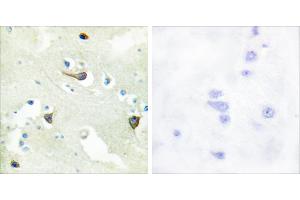 Peptide - + (EPH Receptor B1/2/3 (Internal Region) anticorps)