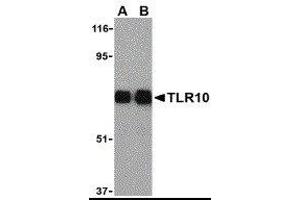 Western Blotting (WB) image for anti-Toll-Like Receptor 10 (TLR10) antibody (ABIN2479798) (TLR10 anticorps)
