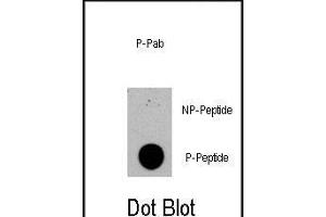 Dot blot analysis of anti-TSC2-p Phospho-specific Pab (R) on nitrocellulose membrane. (Tuberin anticorps  (pSer1420))
