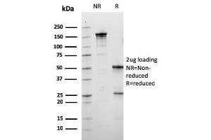 SDS-PAGE Analysis Purified Calbindin 1 Mouse Monoclonal Antibody (CALB1/3333). (CALB1 anticorps  (AA 7-96))