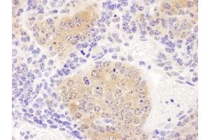 Immunohistochemistry (IHC) image for anti-Chaperonin Containing TCP1, Subunit 8 (Theta) (CCT8) (AA 398-448) antibody (ABIN7453619) (CCT8 anticorps  (AA 398-448))