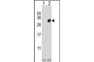 Western blot analysis of GSTO2 (arrow) using rabbit polyclonal GSTO2 Antibody (Center) (ABIN652022 and ABIN2840502).