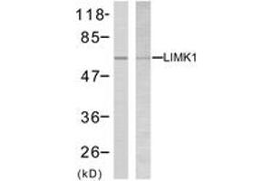 Western blot analysis of extracts from NIH-3T3 cells, treated with UV, using LIMK2 (Ab-505) Antibody. (LIMK2 anticorps  (AA 471-520))