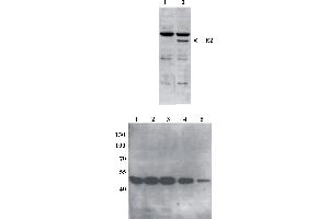 Western Blot testing of anti-BPV E2 DNaseI monoclonal antibody (5E11). (Bovine Papilloma Virus 1 E2 (BPV-1 E2) (AA 199-208) anticorps)