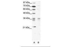 Image no. 1 for anti-BARX Homeobox 1 (BARX1) (AA 91-140) antibody (ABIN202088) (BARX1 anticorps  (AA 91-140))