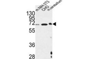 Western Blotting (WB) image for anti-Activating Transcription Factor 6 beta (ATF6B) antibody (ABIN3002237) (ATF6B anticorps)