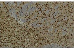 Immunohistochemistry of paraffin-embedded Mouse brain tissue using HIF1 bata Monoclonal Antibody at dilution of 1:200.