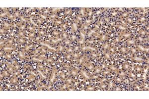 Detection of CBX3 in Mouse Kidney Tissue using Polyclonal Antibody to Chromobox Homolog 3 (CBX3)