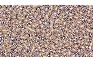 Detection of CBX3 in Mouse Kidney Tissue using Polyclonal Antibody to Chromobox Homolog 3 (CBX3) (CBX3 anticorps  (AA 1-183))