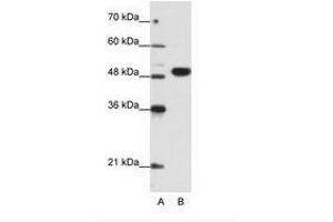 Image no. 1 for anti-Eukaryotic Translation Initiation Factor 4A2 (EIF4A2) (N-Term) antibody (ABIN6736193) (EIF4A2 anticorps  (N-Term))