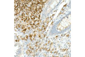 Immunohistochemistry of paraffin-embedded Human appendix using CD19 antibody (ABIN7266169) at dilution of 1:10000 (40x lens).