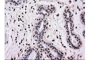 Immunohistochemical staining of paraffin-embedded breast tissue using anti-MRI1 mouse monoclonal antibody. (MRI1 anticorps)