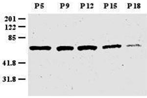 Anti-Zic1 Antibody - Western Blot.