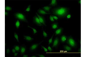 Immunofluorescence of monoclonal antibody to USP34 on HeLa cell. (USP34 anticorps  (AA 3296-3395))