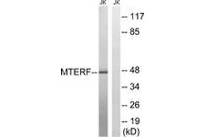 Western blot analysis of extracts from Jurkat cells, using MTERF Antibody. (MTERF anticorps  (AA 267-316))
