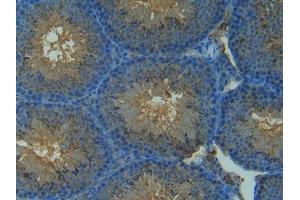 Detection of NOS2 in Mouse Testis Tissue using Polyclonal Antibody to Nitric Oxide Synthase 2, Inducible (NOS2)