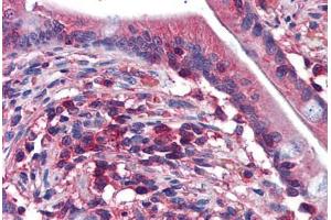 Human Small Intestine: Formalin-Fixed, Paraffin-Embedded (FFPE) (EDC4 anticorps  (AA 1302-1402))