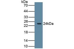 Detection of Recombinant ARO, Rat using Polyclonal Antibody to Aromatase (ARO)