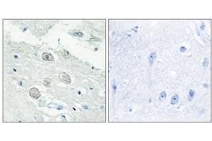 Immunohistochemistry analysis of paraffin-embedded human brain tissue, using JAK1 antibody. (JAK1 anticorps  (N-Term))