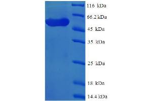 SDS-PAGE (SDS) image for Sex Comb On Midleg-Like 4 (SCML4) (AA 1-305) protein (His-SUMO Tag) (ABIN5711593)