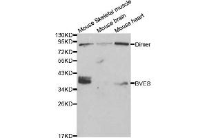 Western blot analysis of extracts of various cell lines, using BVES antibody (ABIN5970046) at 1/1000 dilution.