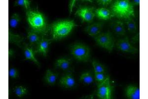 Anti-KRT8 mouse monoclonal antibody (ABIN2452366) immunofluorescent staining of COS7 cells transiently transfected by pCMV6-ENTRY KRT8 (RC209570). (KRT8 anticorps  (AA 91-381))