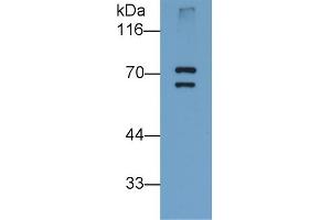 Detection of PADI6 in Human Placenta lysate using Monoclonal Antibody to Peptidyl Arginine Deiminase Type VI (PADI6) (PADI6 anticorps  (AA 393-694))