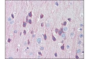 Image no. 3 for anti-Lysosomal-Associated Membrane Protein 1 (LAMP1) (Center) antibody (ABIN303277) (LAMP1 anticorps  (Center))