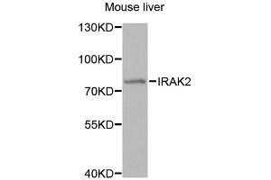 Western blot analysis of extracts of mouse liver, using IRAK2 antibody (ABIN1873258) at 1:1000 dilution.