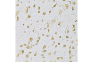 Immunohistochemistry of paraffin-embedded mouse brain using CBX8 Antibody (ABIN5973663) at dilution of 1/100 (40x lens). (CBX8 anticorps)