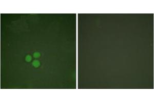 Immunofluorescence analysis of HeLa cells, treated with Forskolin (40nM, 30mins), using DP-1 antibody.