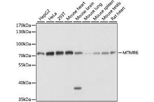 Western blot analysis of extracts of various cell lines, using MTMR6 antibody. (MTMR6 anticorps)