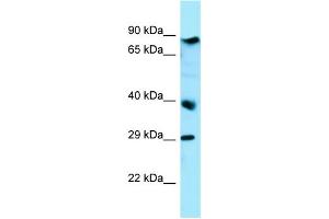 WB Suggested Anti-BRAT1 Antibody Titration: 1. (BAAT1 anticorps  (C-Term))
