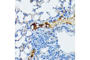 Immunohistochemistry of paraffin-embedded mouse lung using Fibrinogen alpha chain (FGA) (FGA) Rabbit mAb (ABIN7267177) at dilution of 1:100 (40x lens).