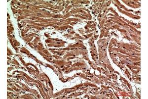 Immunohistochemical analysis of paraffin-embedded human-heart, antibody was diluted at 1:200