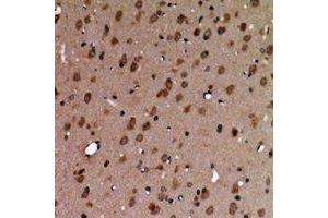 Immunohistochemical analysis of AAK1 staining in human brain formalin fixed paraffin embedded tissue section.