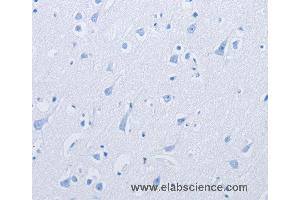 Immunohistochemistry of  using KCNMB3 Polyclonal Antibody at dilution of 1: (KCNMB3 anticorps)
