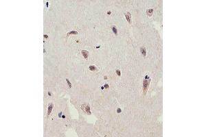 Immunohistochemical analysis of paraffin-embedded H. (C13orf30 anticorps  (C-Term))