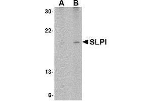 Western Blotting (WB) image for anti-Secretory Leukocyte Peptidase Inhibitor (SLPI) (Middle Region) antibody (ABIN1031101) (SLPI anticorps  (Middle Region))