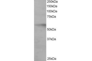 Western Blotting (WB) image for anti-Interferon Regulatory Factor 6 (IRF6) (C-Term) antibody (ABIN2465855) (IRF6 anticorps  (C-Term))