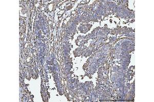 IHC analysis of HLA-DRA using anti-HLA-DRA antibody (ABIN7600949).