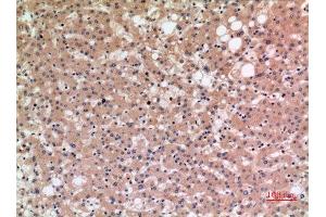 Immunohistochemistry (IHC) analysis of paraffin-embedded Human Liver, antibody was diluted at 1:100.