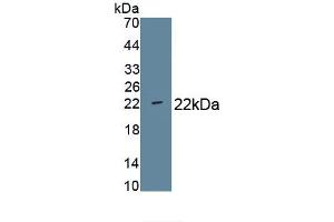 Detection of Recombinant CD276, Human using Monoclonal Antibody to Cluster Of Differentiation 276 (CD276) (CD276 anticorps  (AA 47-219))