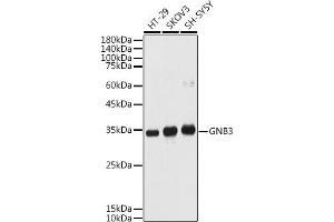 Western blot analysis of extracts of various cell lines, using GNB3 antibody (ABIN1680055, ABIN3015467, ABIN3015468 and ABIN6218020) at 1:1000 dilution.