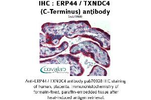 Image no. 2 for anti-Endoplasmic Reticulum Protein 44 (ERP44) (C-Term) antibody (ABIN1734140) (ERP44 anticorps  (C-Term))