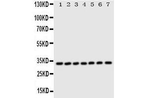 Western Blotting (WB) image for anti-Enoyl-CoA Delta Isomerase 1 (ECI1) (AA 272-290), (C-Term) antibody (ABIN3044153)