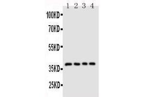 Anti-CD1d antibody, Western blotting Lane 1: COLO320 Cell Lysate Lane 2: HELA Cell Lysate Lane 3:  Cell Lysate Lane 4: JURKAT Cell Lysate (CD1d anticorps  (N-Term))