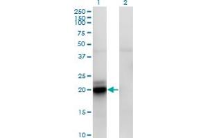 Western Blot analysis of ACOT9 expression in transfected 293T cell line by ACATE2 monoclonal antibody (M01), clone 4E4.