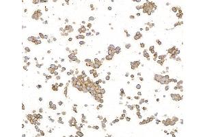 Immunocytochemistry (ICC) image for anti-Neural Cell Adhesion Molecule 1 (NCAM1) (AA 20-318) antibody (ABIN7449431)